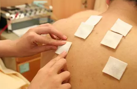 孩子咳喘發作能貼三伏貼嗎2018 寶寶正在發燒還能貼三伏貼嗎