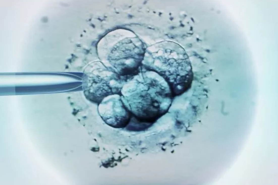 高齡產婦做試管嬰兒成功率有多少 高齡女性做試管嬰兒要注意什么 高齡產婦做試管嬰兒成功率有多少 高齡女性做試管嬰兒要注意什么