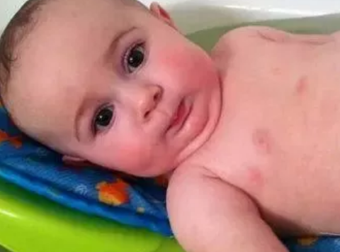 寶寶有鼻痂怎么清理2018 寶寶鼻塞怎么預(yù)防