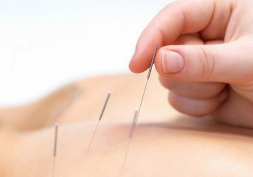 如何提高人工授精的成功率 針灸能提高人工授精成功率嗎 如何提高人工授精的成功率 針灸能提高人工授精成功率嗎