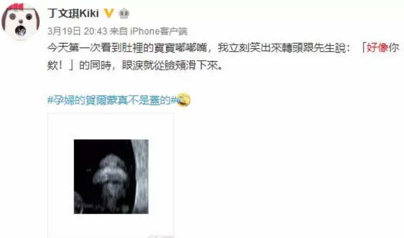 孕期衣食住行需要注意什么 孕晚期衣食住行攻略