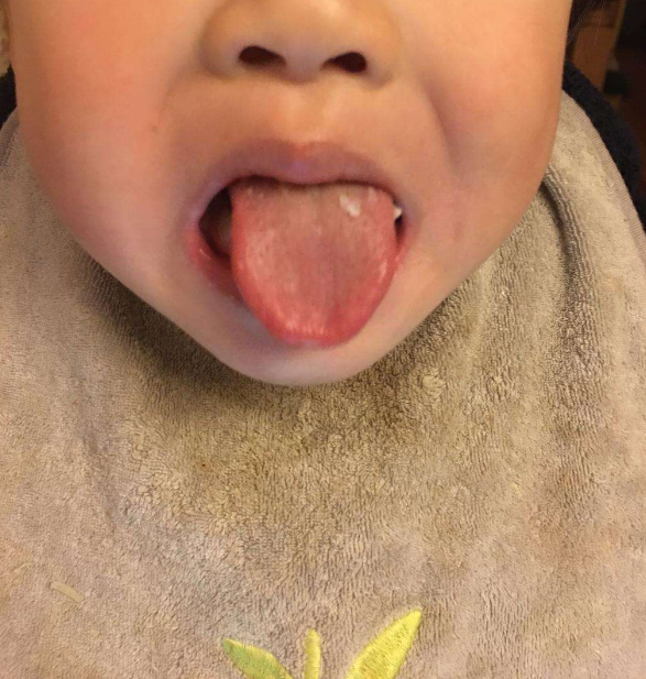 寶寶積食會(huì)怎么樣 2018寶寶積食有哪些危害 寶寶積食會(huì)怎么樣 2018寶寶積食有哪些危害