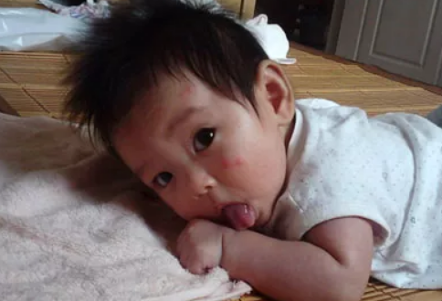 小孩子被蚊子叮出包怎么辦2018 家里有小孩使用驅蚊劑要注意什么