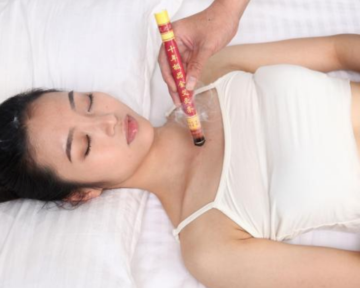 三伏天減肥怎么艾灸 2018三伏天艾灸減肥穴位原理方法 三伏天減肥怎么艾灸 2018三伏天艾灸減肥穴位原理方法