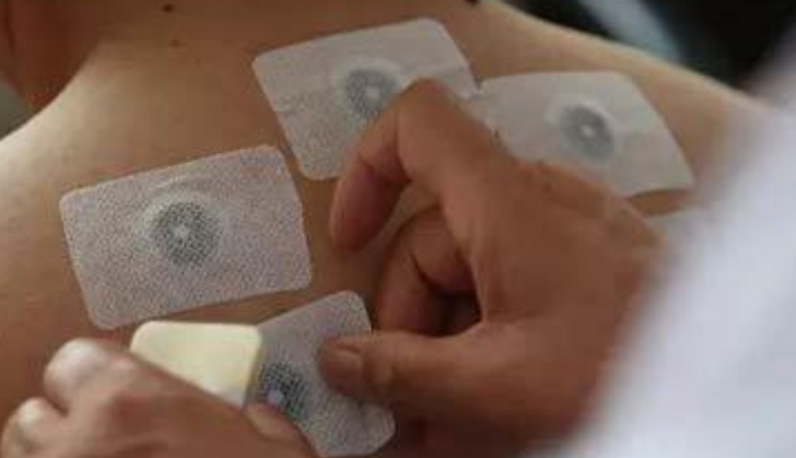 自己做三伏貼買什么藥材 自己做的三伏貼怎么貼2018