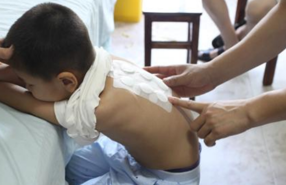 2018三伏天分三貼時間日期 三伏貼什么時候貼最合適呢