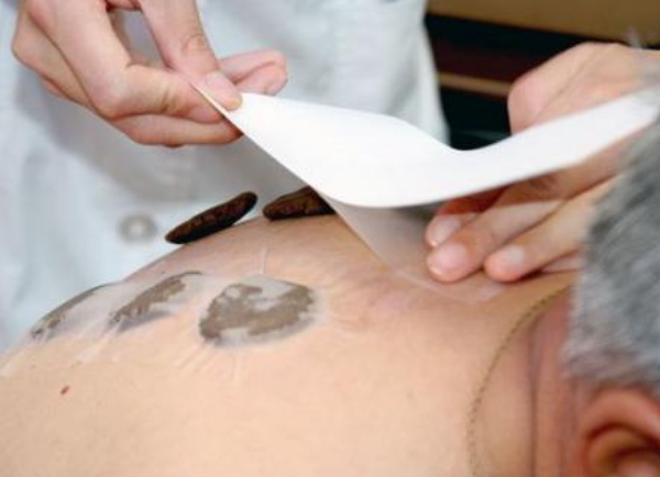 夏天貼三伏貼可以治什么病 三伏貼小孩老人可以貼嗎