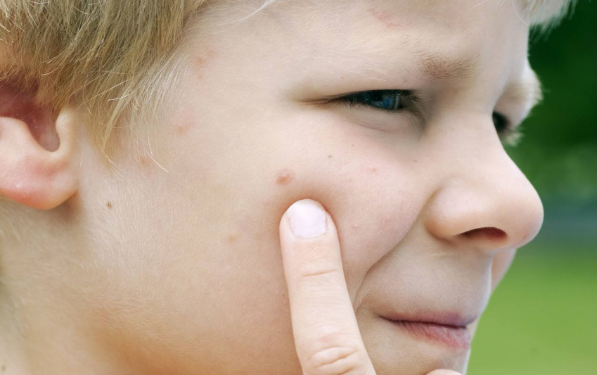 寶寶可以使用蚊香嗎 蚊子喜歡咬寶寶用什么方法驅(qū)蚊比較好2018