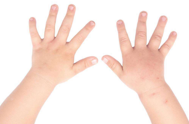 寶寶可以使用蚊香嗎 蚊子喜歡咬寶寶用什么方法驅(qū)蚊比較好2018