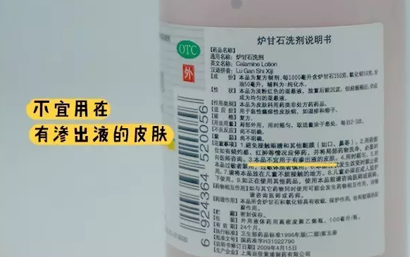 爐甘石洗劑寶寶怎么用 爐甘石洗劑能用來蚊叮止癢嗎