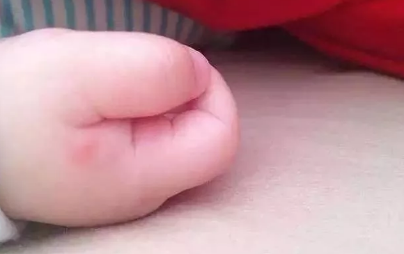 澳洲木瓜膏多大寶寶能用 寶寶蚊子咬了能用木瓜膏嗎 澳洲木瓜膏多大寶寶能用 寶寶蚊子咬了能用木瓜膏嗎