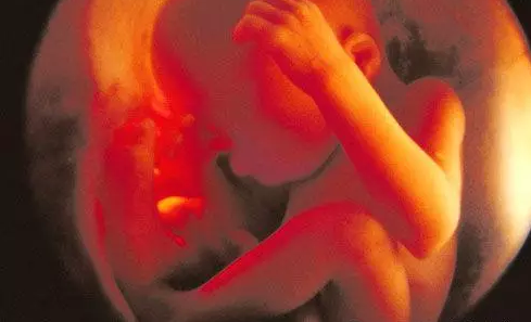 懷孕七個月胎兒長什么樣子 懷孕七個月胎兒圖2018