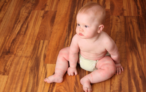 小孩長了蕁麻疹打針還是吃藥 小孩長蕁麻疹怎么辦