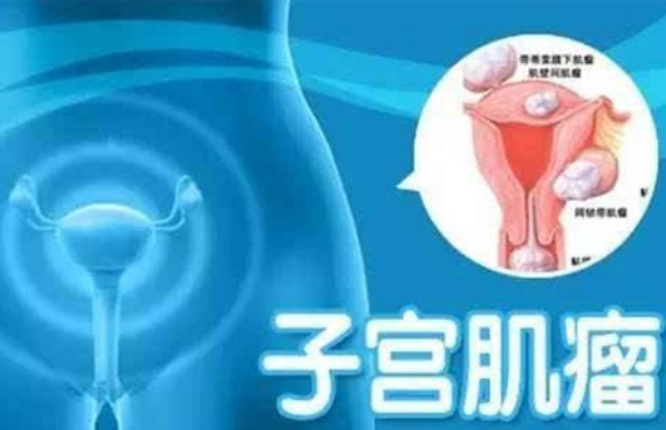 子宮肌瘤對懷孕影響大 檢查出子宮肌瘤還能生小孩嗎