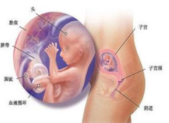 懷孕子宮肌瘤的常見癥狀 子宮肌瘤會引起不孕癥嗎