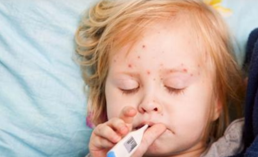 寶寶牛奶蛋白過敏怎么喝奶粉 牛奶蛋白過敏檢查方法2018 寶寶牛奶蛋白過敏怎么喝奶粉 牛奶蛋白過敏檢查方法2018