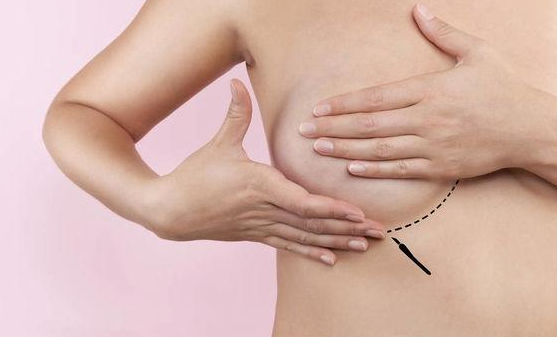 生完孩子怎么豐胸好 生完孩子后豐胸方法2018 生完孩子怎么豐胸好 生完孩子后豐胸方法2018