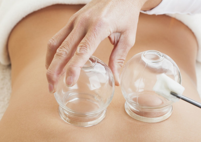 月經期間可以拔火罐嗎 夏季拔火罐要注意什么2018 月經期間可以拔火罐嗎 夏季拔火罐要注意什么2018