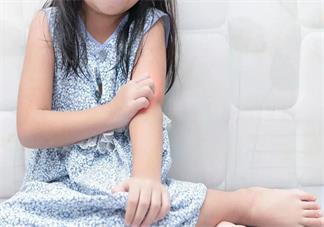 孩子夏天為什么會(huì)長(zhǎng)痱子 孩子夏天長(zhǎng)痱子怎么辦好2018