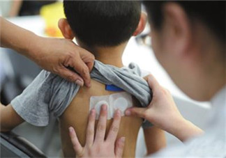 多大的孩子可以貼三伏貼 2歲以下不適宜敷貼