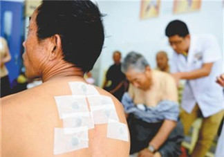 三伏貼什么時候貼最好 三伏貼不建議晚上貼 三伏貼什么時候貼最好 三伏貼不建議晚上貼