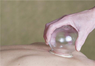 拔罐后可以立即洗澡嗎 拔罐后立即洗澡危害多