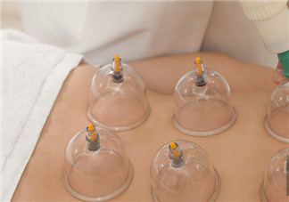 三伏天拔罐要注意什么 哪些人不宜拔罐2018