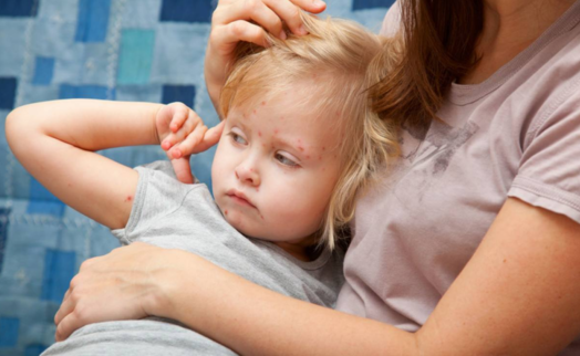 寶寶體質與哪些因素有關系 夏季孩子可以貼三伏貼針灸嗎 寶寶體質與哪些因素有關系 夏季孩子可以貼三伏貼針灸嗎