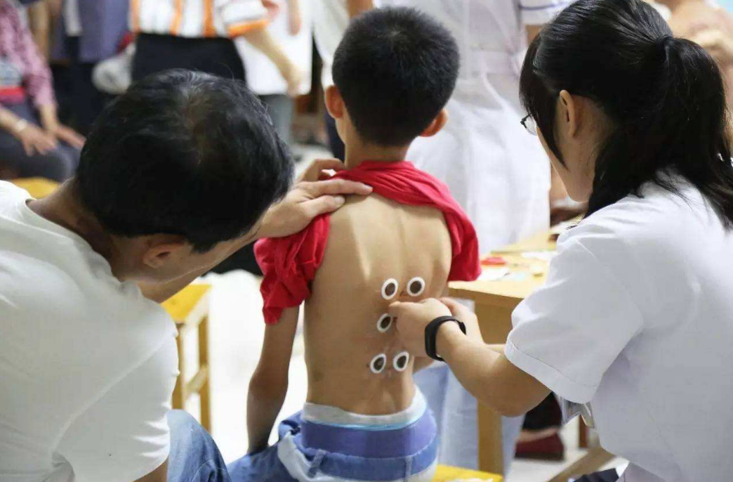 寶寶體質與哪些因素有關系 夏季孩子可以貼三伏貼針灸嗎 寶寶體質與哪些因素有關系 夏季孩子可以貼三伏貼針灸嗎