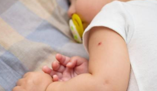 香港打四痘疫苗怎么打 麻腮風水痘四痘疫苗去香港打有必要嗎