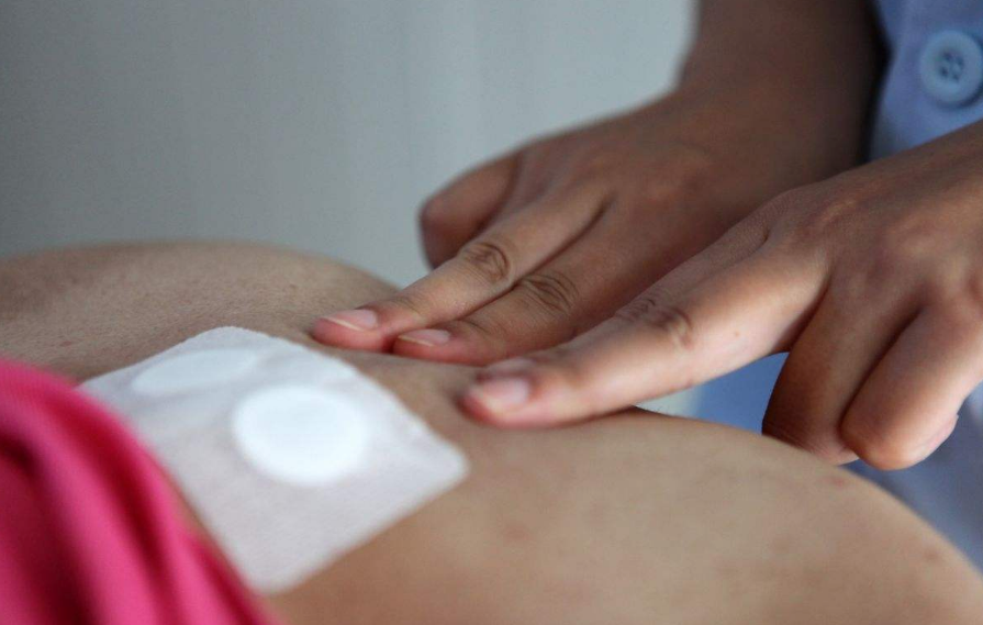 三伏貼一定要在入伏當天貼嗎 三伏貼什么時候開始貼