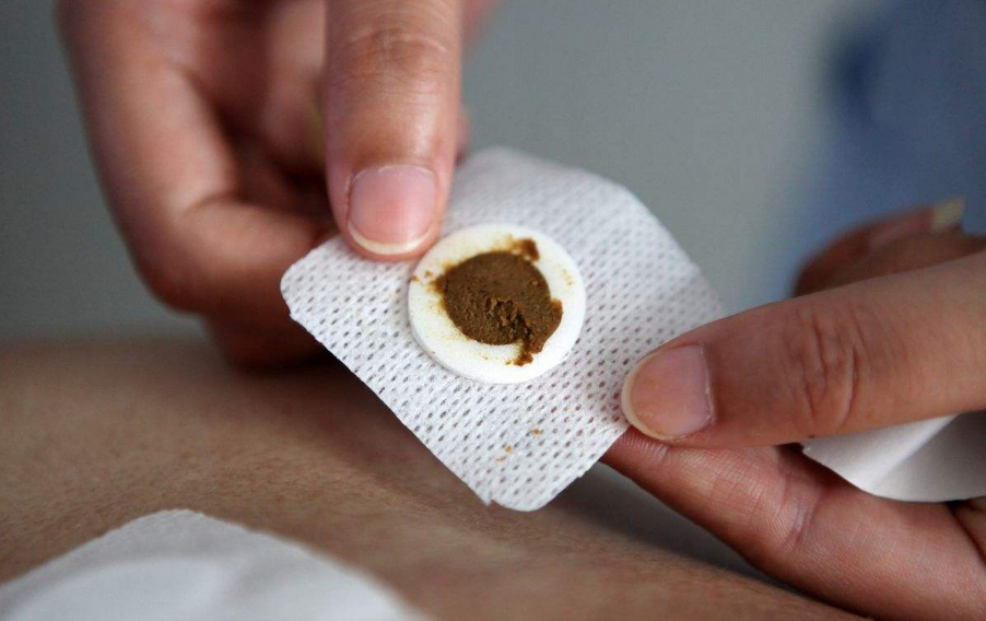 三伏貼一定要在入伏當天貼嗎 三伏貼什么時候開始貼