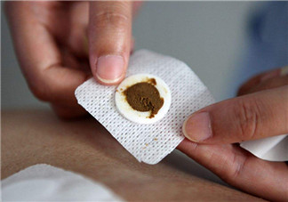 兒童三伏貼常見穴位有哪些 孩子貼三伏貼什么穴位好