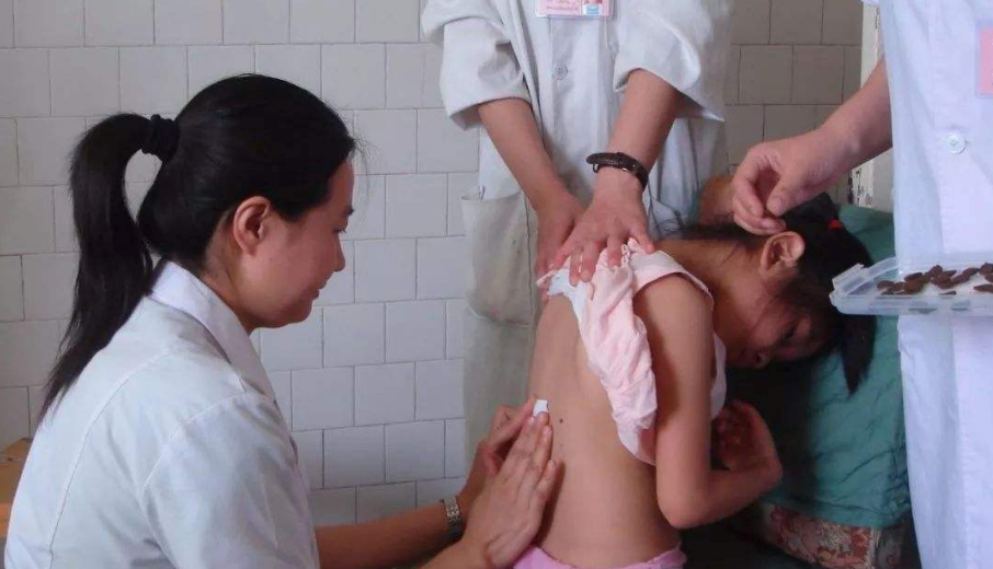 兒童三伏貼常見穴位有哪些 孩子貼三伏貼什么穴位好