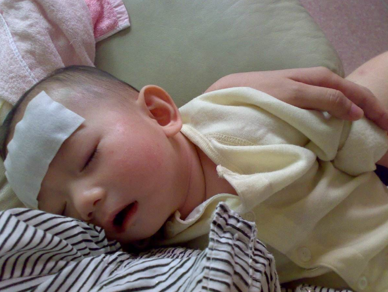 6個(gè)月到3歲幼兒發(fā)燒的處理方式 寶寶發(fā)燒怎么辦好