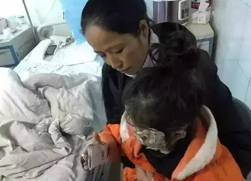 三星手機(jī)炸傷女童毀容 炸傷女童家屬索賠百萬(wàn)