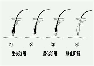生完孩子之后為什么會出現(xiàn)脫發(fā) 產后脫發(fā)具體原因