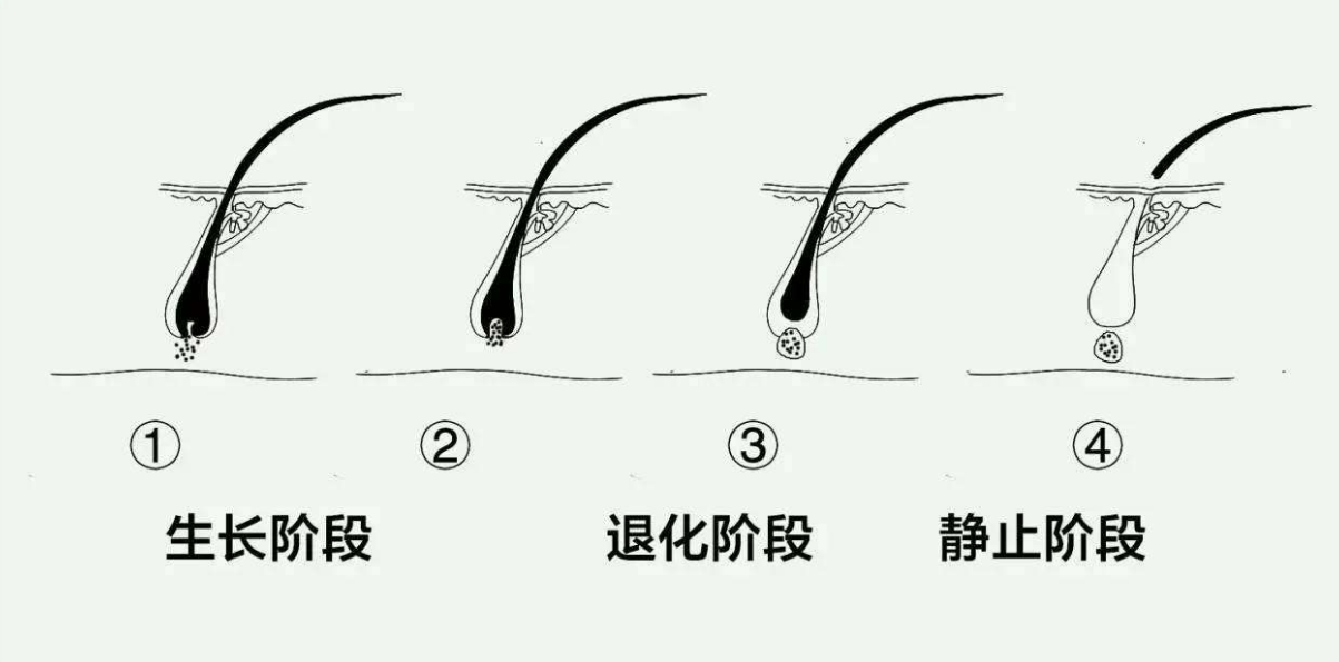 生完孩子之后為什么會出現脫發 產后脫發具體原因 生完孩子之后為什么會出現脫發 產后脫發具體原因