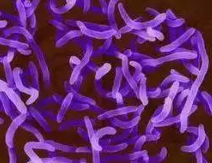 夏季感染單增李斯特菌后的癥狀有哪些 天熱如何預防細菌感染