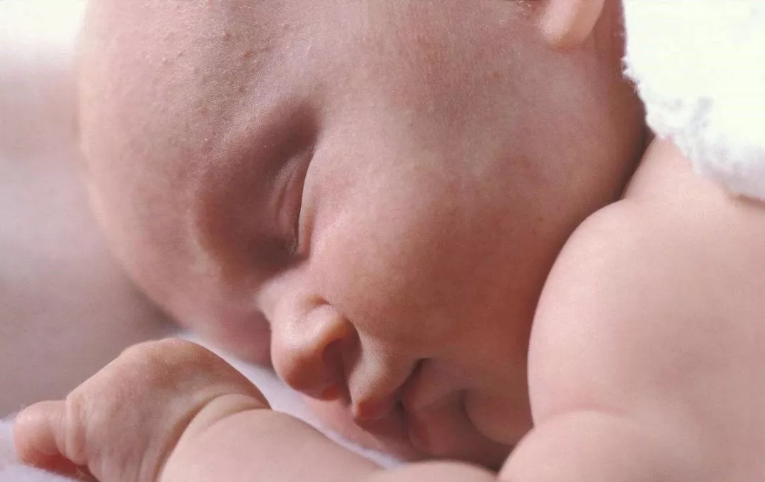 寶寶生下來(lái)生下來(lái)有黃疸是胎毒嗎 寶寶出生后的疾病是胎毒造成的嗎