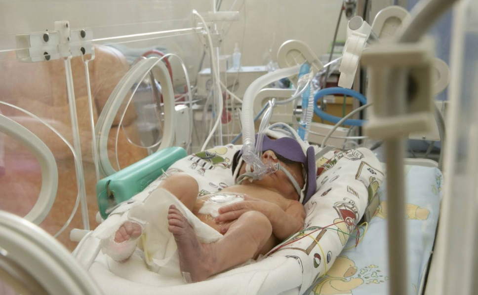 如何辨別是不是新生兒黃疸 新生兒黃疸辨識卡怎么用