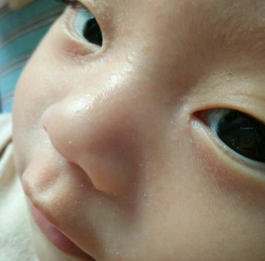 松達山茶油兒童面霜怎么樣 松達山茶油兒童面霜對濕疹有效果嗎 松達山茶油兒童面霜怎么樣 松達山茶油兒童面霜對濕疹有效果嗎