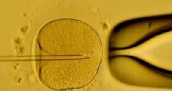 試管嬰兒移植后出現(xiàn)嘔吐正常嗎 試管嬰兒移植后出現(xiàn)嘔吐怎么辦