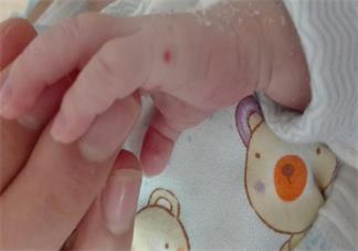 寶寶夏日如何避免蚊子叮咬 寶寶容易被蚊子咬怎么辦好