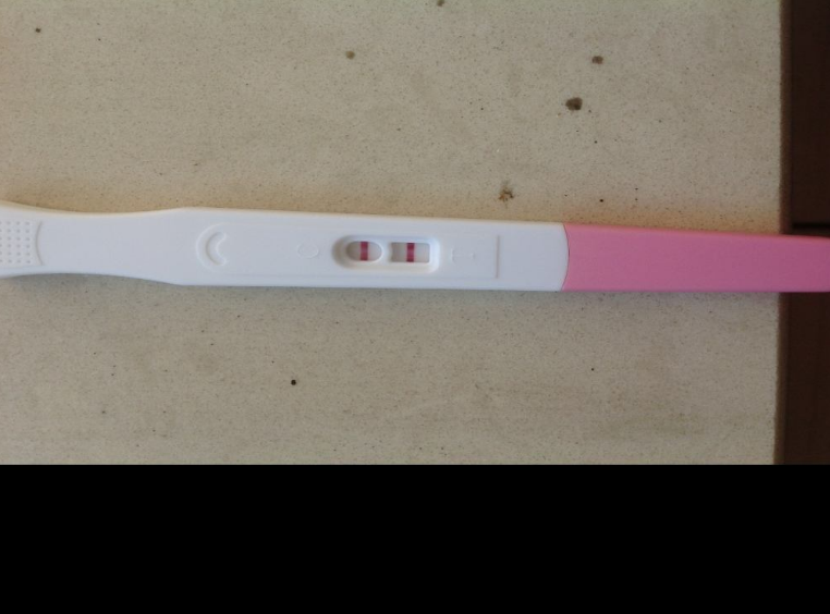 白帶增多就是婦科病嗎 正常的白帶是什么樣的 白帶增多就是婦科病嗎 正常的白帶是什么樣的