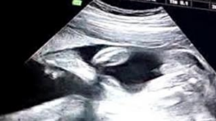 懷孕的月份數(shù)怎么看生男生女 懷孕的月份數(shù)看生男生女公式