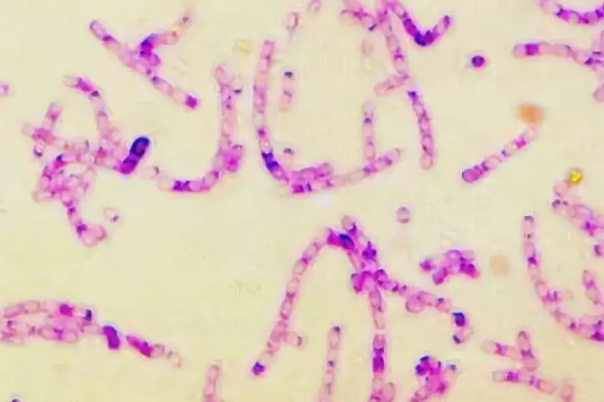 人是怎么感染上炭疽的 人類感染炭疽的三種途徑