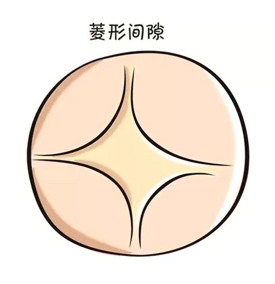 寶寶囟門凸起怎么回事 寶寶囟門什么情況不對勁