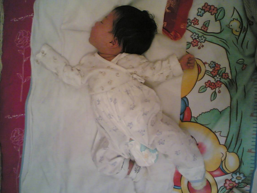 寶寶囟門凸起怎么回事 寶寶囟門什么情況不對勁