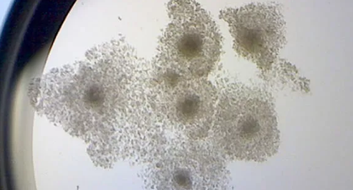 打達(dá)必佳期間發(fā)現(xiàn)懷孕了怎么辦 打了達(dá)必佳小孩能要嗎 打達(dá)必佳期間發(fā)現(xiàn)懷孕了怎么辦 打了達(dá)必佳小孩能要嗎